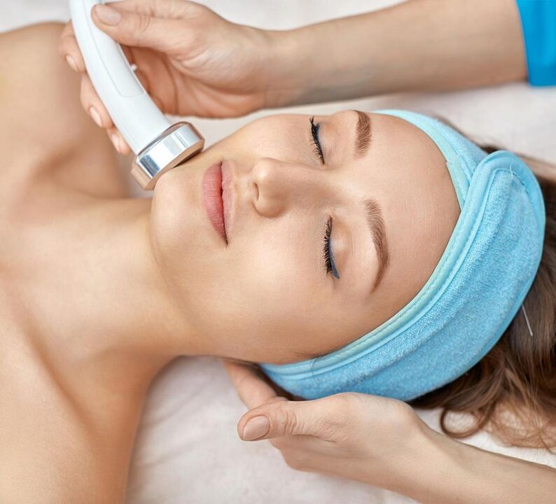 Sollevamento del viso RF facciale